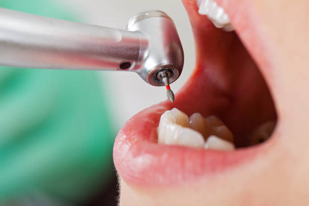 Best Emergency Dental Care for Broken or Chipped Teeth in Atwood, TN
